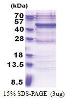 VAV1 (189-565, His-tag) Human Protein