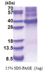 HOXB13 (1-284, His-tag) Human Protein