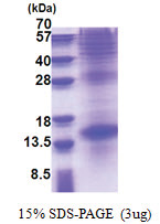 Thyrotropin beta chain (21-138, His-tag) Human Protein