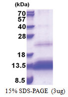 TRIAP1 (1-76, His-tag) Human Protein