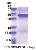 SSR1 / TRAPA (22-207, His-tag) Human Protein