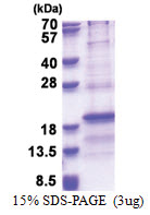 RPL31 (1-125, His-tag) Human Protein