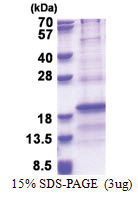 RPL31 (1-125, His-tag) Human Protein