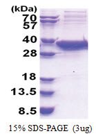 SIRT5 (34-310, His-tag) Human Protein