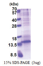 CXCL13 / BCA1 (23-109, His-tag) Human Protein