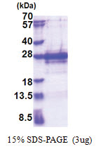 PPP1R2 / IPP2 (1-166, His-tag) Human Protein