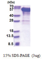 Dynactin subunit 2 (1-401, His-tag) Human Protein