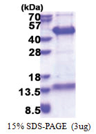 FAM84B (1-310, His-tag) Human Protein