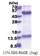 FAM84B (1-310, His-tag) Human Protein