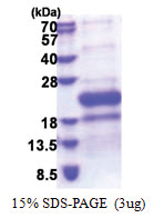 TNFRSF14 / HVEM (39-202, His-tag) Human Protein