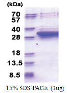 DCI (42-302, His-tag) Human Protein