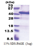 USF1 (1-310, His-tag) Human Protein