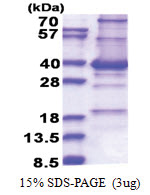 CENP-P (1-288, His-tag) Human Protein