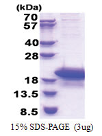 ARPP19 (1-112, His-tag) Human Protein