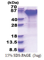 Dynactin subunit 2 (1-403, His-tag) Human Protein