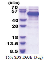 RBM17 / SPF45 (1-401, His-tag) Human Protein