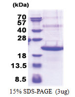 TREM2 (19-161, His-tag) Human Protein