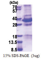 MAGE-D1 (504-760, His-tag) Human Protein