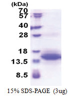 UQCRH (Mitochondrial hinge protein) (14-91, His-tag) Human Protein