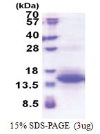 UQCRH (Mitochondrial hinge protein) (14-91, His-tag) Human Protein
