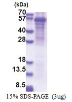 Oleamide hydrolase 2 (32-532, His-tag) Human Protein