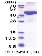 PRPSAP2 (1-369, His-tag) Human Protein
