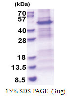 NDUFS2 (77-463, His-tag) Human Protein