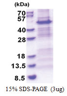 NDUFS2 (77-463, His-tag) Human Protein
