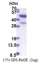 MBIP (1-344, His-tag) Human Protein