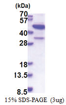 MBIP (1-344, His-tag) Human Protein