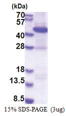 RAD51L1 (1-350, His-tag) Human Protein