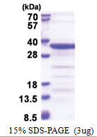 TAF15 (148-406, His-tag) Human Protein