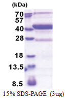 Methionine aminopeptidase 1D / MAP1D (20-335, His-tag) Human Protein