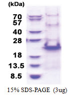RPS20 (1-142, His-tag) Human Protein