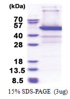 PSMD11 (1-422, His-tag) Human Protein