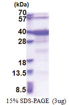 GTF2A1 / TF2A1 (1-274, His-tag) Human Protein