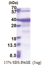 GTF2A1 / TF2A1 (1-274, His-tag) Human Protein