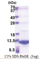 Neuregulin 4 (1-61, His-tag) Human Protein