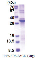 SLA2 (1-261, His-tag) Human Protein