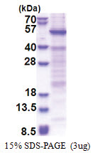 HSFY1 / HSFY2 (1-401, His-tag) Human Protein