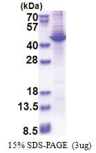 Apolipoprotein A V / ApoA5 (24-366, His-tag) Human Protein