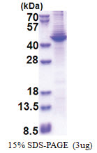 Apolipoprotein A V / ApoA5 (24-366, His-tag) Human Protein