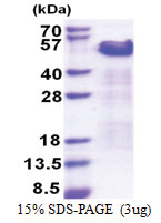 TRIP10 (260-545, His-tag) Human Protein