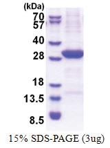 VTCN1 / B7H4 (25-259, His-tag) Human Protein