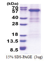 Complement factor B (260-764, His-tag) Human Protein