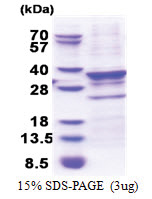 CENP-Q (His-tag) Human Protein