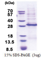 DLX3 (His-tag) Human Protein