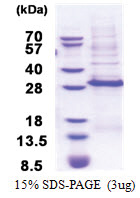 DLX3 (His-tag) Human Protein