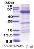 CD29 / Integrin beta-1 (21-461, His-tag) Human Protein