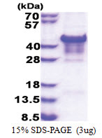 Carbonic anhydrase 14 (16-290, His-tag) Human Protein